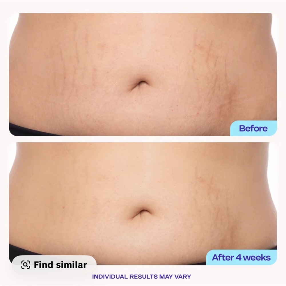 GoPure Tighten & Smooth Belly Cream - Picture 5 of 8